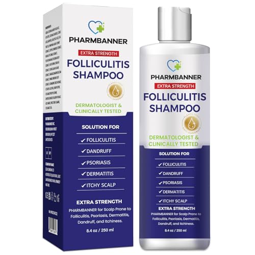 best antifungal shampoo for itchy scalp